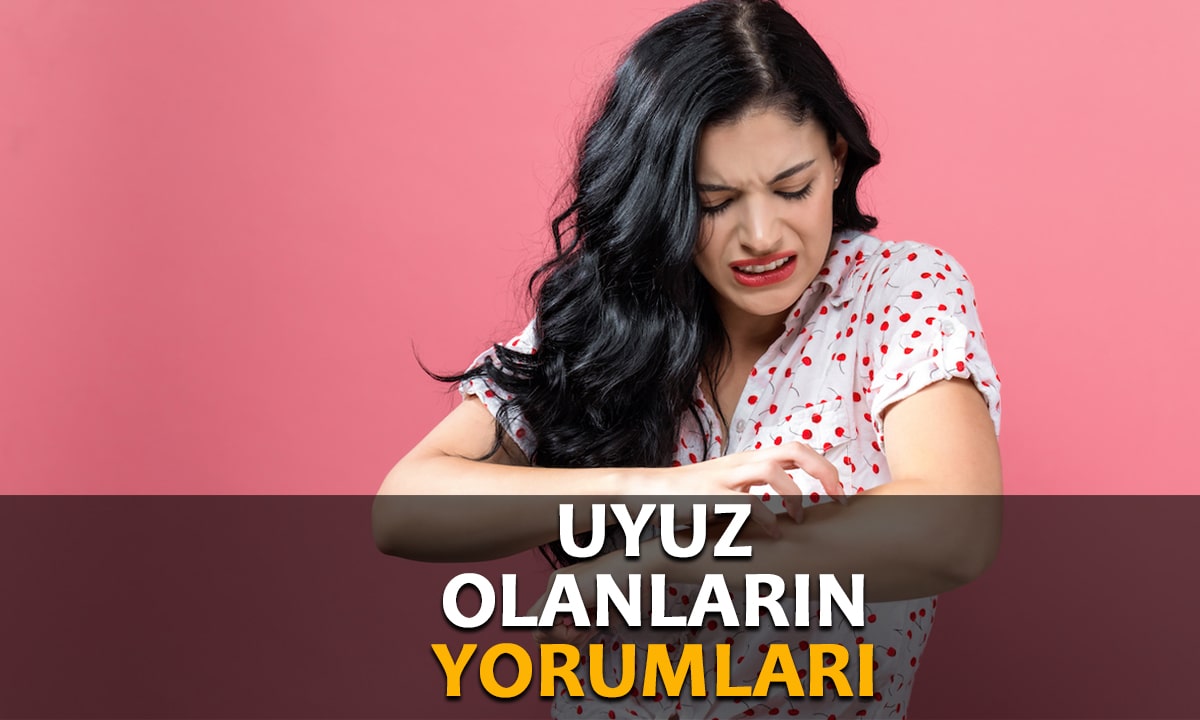 Uyuz Olanların Yorumları