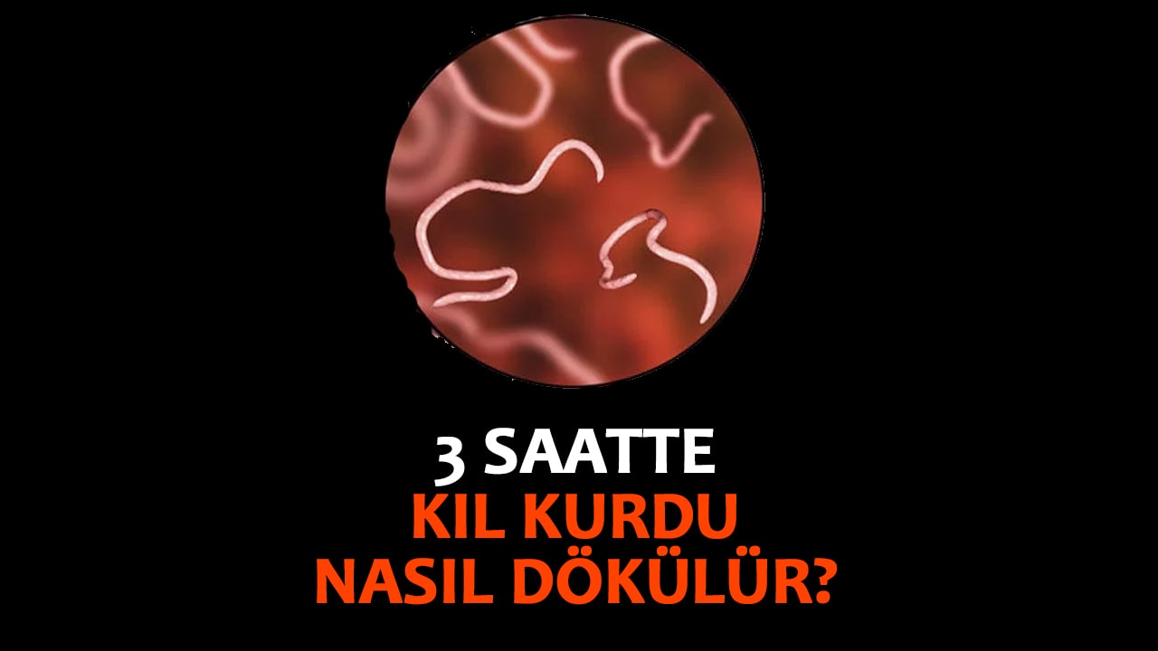3 Saatte Kıl Kurdu Nasıl Dökülür